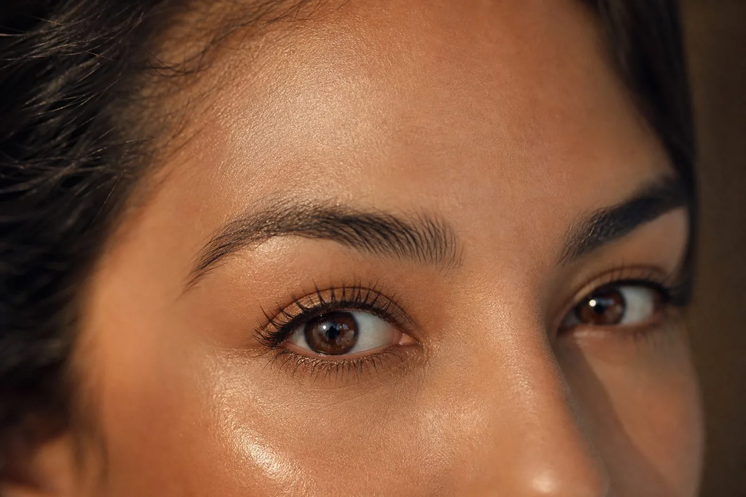 Blefaroplastia — BET Aesthetics Center